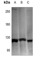 1 - Anti-Hexokinase 1 Antibody AP60316