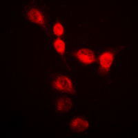 3 - Anti-hnRNP A2/B1 Antibody AP60318
