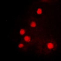 3 - Anti-HOXC6 Antibody AP60319