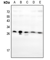 1 - Anti-HOXC6 Antibody AP60319