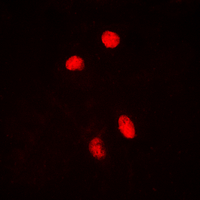 3 - Anti-HSF1 (Phospho-S303) Antibody AP60320