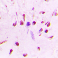 19 - Anti-HSF1 (Phospho-S303) Antibody AP60320