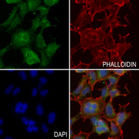 3 - Anti-IGFBP3 Antibody AP60321