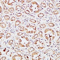 19 - Anti-IGFBP3 Antibody AP60321