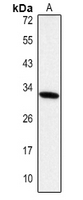 1 - Anti-IGFBP3 Antibody AP60321
