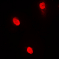 3 - Anti-AIOLOS Antibody AP60323