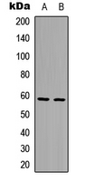 1 - Anti-AIOLOS Antibody AP60323