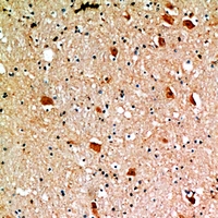 19 - Anti-CD218b Antibody AP60324