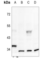 1 - Anti-Inhibin alpha Antibody AP60326