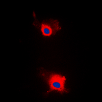 3 - Anti-IRS1 (Phospho-S636) Antibody AP60327