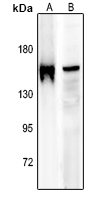 1 - Anti-IRS1 (Phospho-S636) Antibody AP60327