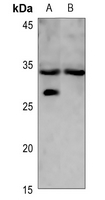 1 - Anti-LYL1 Antibody AP60335