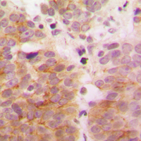 19 - Anti-TAK1 Antibody AP60337