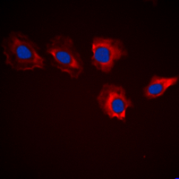 3 - Anti-MARK3 Antibody AP60339