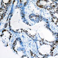 19 - Anti-MSH3 Antibody AP60340