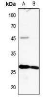 1 - Anti-MYL3 Antibody AP60342