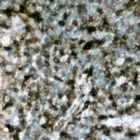 19 - Anti-p47 phox (Phospho-S304) Antibody AP60344