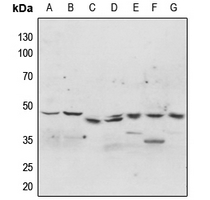 1 - Anti-p47 phox (Phospho-S304) Antibody AP60344