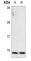 1 - Anti-NDUFA3 Antibody AP60345