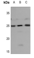 1 - Anti-NDUFB9 Antibody AP60346
