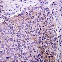 19 - Anti-pro-NGF beta Antibody AP60349