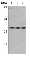1 - Anti-pro-NGF beta Antibody AP60349