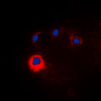 3 - Anti-NOTCH1 Antibody AP60350