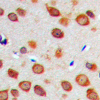 19 - Anti-NOTCH1 Antibody AP60350