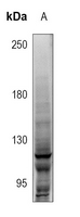 1 - Anti-NOTCH1 Antibody AP60350
