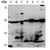 1 - Anti-NPDC1 Antibody AP60351