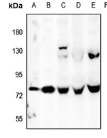 1 - Anti-OLFML2A Antibody AP60355