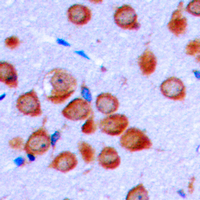 19 - Anti-OLFML2B Antibody AP60356