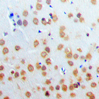 19 - Anti-PARP3 Antibody AP60358