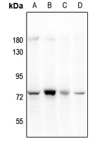 1 - Anti-PARP3 Antibody AP60358
