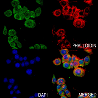 3 - Anti-PCK1 Antibody AP60359