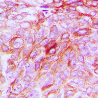 19 - Anti-Phospholipase D4 Antibody AP60360
