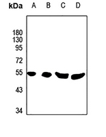 1 - Anti-Phospholipase D4 Antibody AP60360