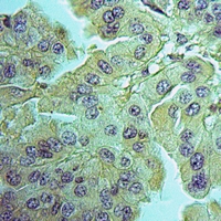 19 - Anti-PNPLA6 Antibody AP60361