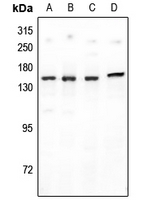 1 - Anti-PNPLA6 Antibody AP60361