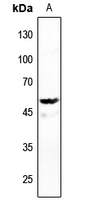 1 - Anti-DNA Polymerase gamma 2 Antibody AP60362