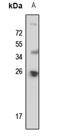1 - Anti-POLR2E Antibody AP60363