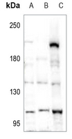 1 - Anti-POM121 Antibody AP60364