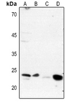 1 - Anti-DARPP32 (Phospho-T75) Antibody AP60365