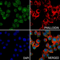 3 - Anti-PPP2R5D Antibody AP60366