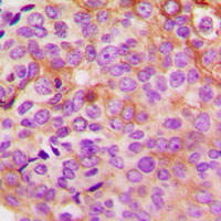 19 - Anti-PKA C gamma Antibody AP60367