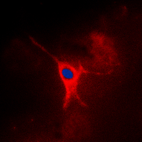 3 - Anti-AMPK gamma 2 Antibody AP60368