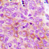 19 - Anti-AMPK gamma 2 Antibody AP60368