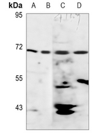 1 - Anti-AMPK gamma 2 Antibody AP60368