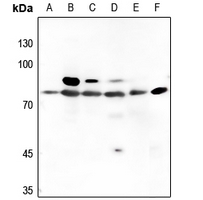 1 - Anti-PKC beta Antibody AP60369
