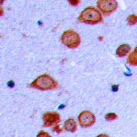 19 - Anti-PRKD2 (Phospho-S876) Antibody AP60370